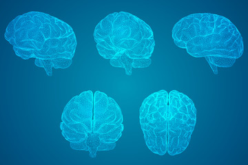 十大暖气片排名是谁